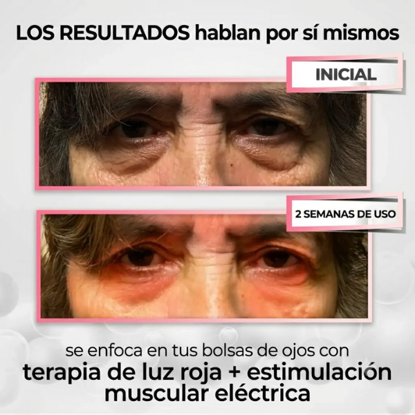 Aureva Iluminador de Ojos