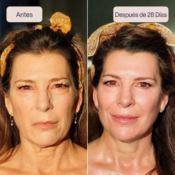 Aureva Lifting de ojos